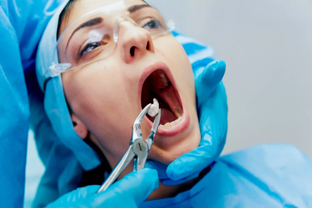 wisdom-tooth-extraction
