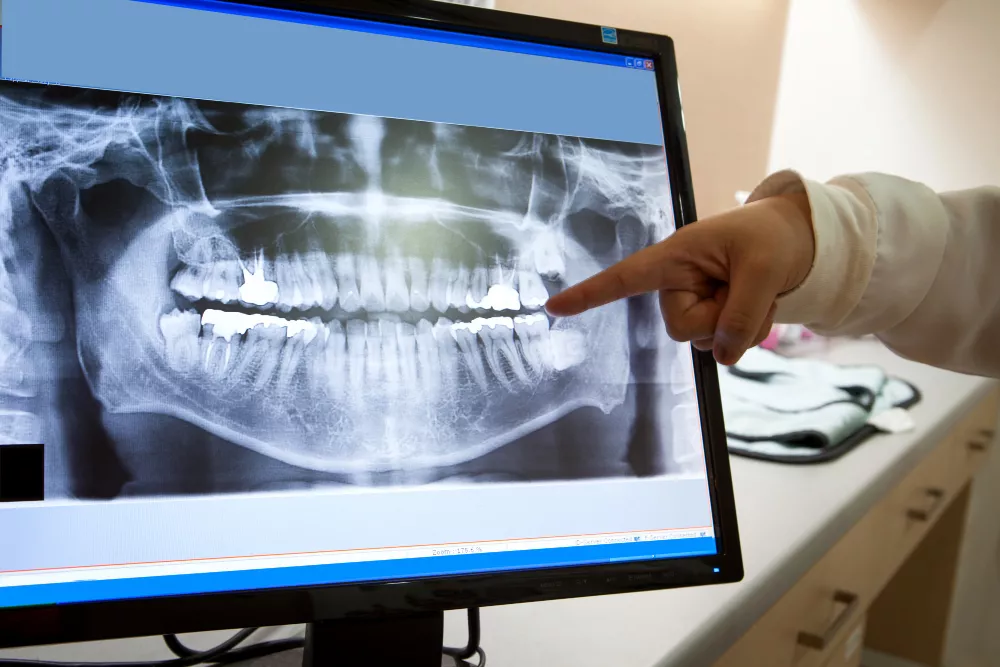 digital x ray